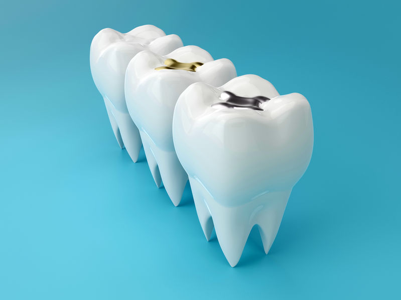 know about tooth fillings